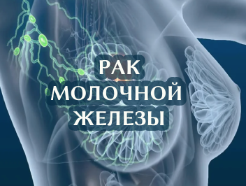 Рак молочной железы (рак груди): симптомы и лечение