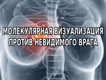 Молекулярная визуализация молочной железы
